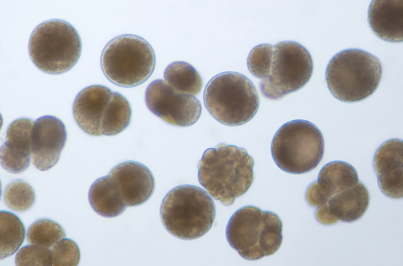 Moule (Mytilus edulis) - Embryons à divers stades de développement x25